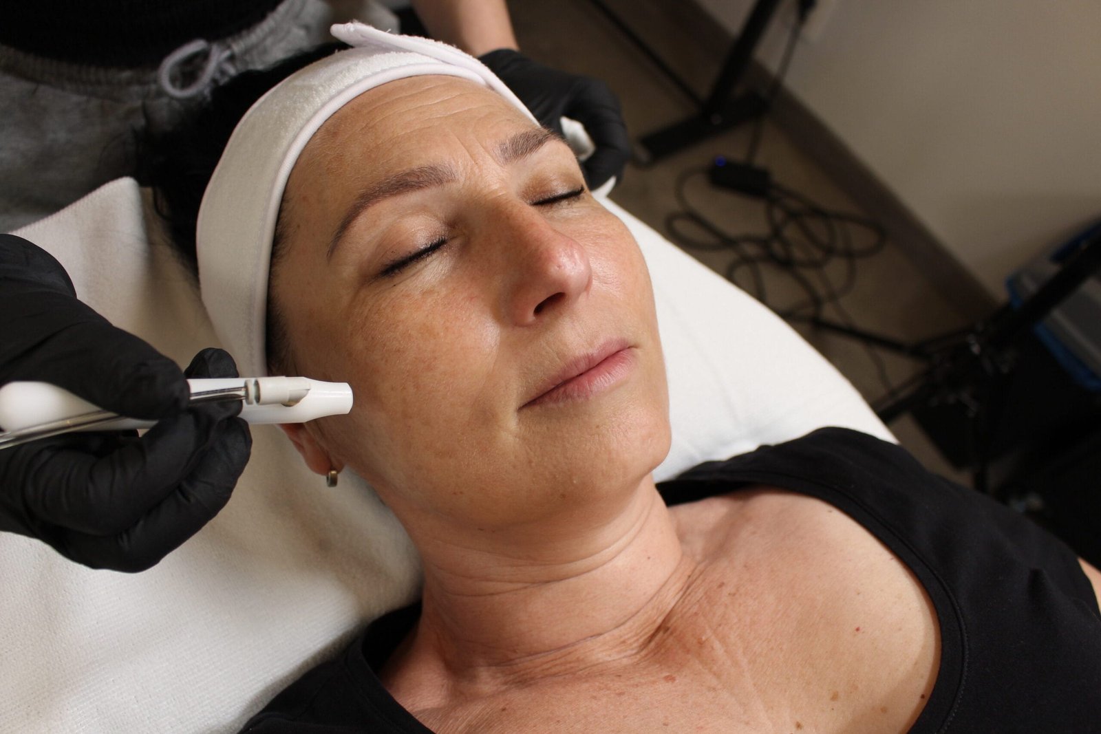 Oxybraziá – Mechanický Peeling pre Čistú a Hladkú Pokožku Oxybraziá – Mechanický Peeling pre Čistú a Hladkú Pokožku