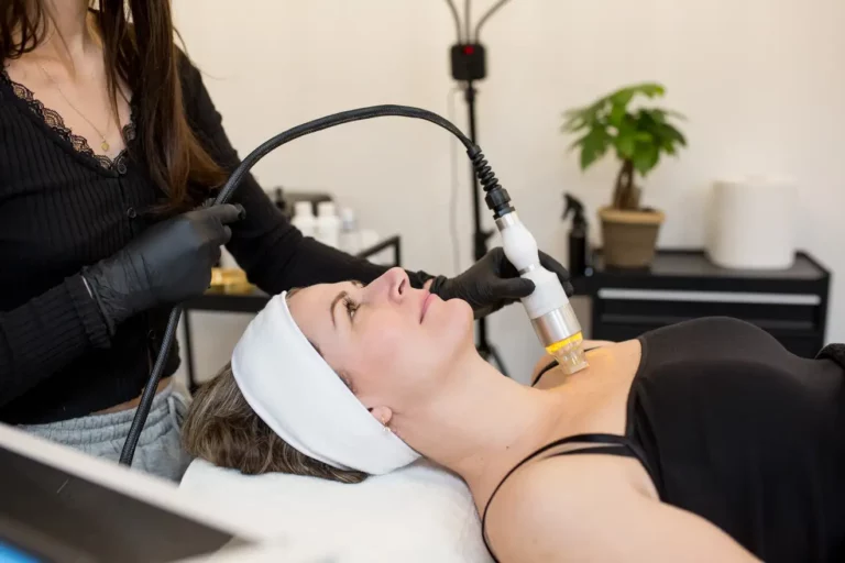 Profesionálne zariadenie na mikroihličkovú rádiofrekvečnú terapiu v kozmetickom salóne ForeverBeauty Košice