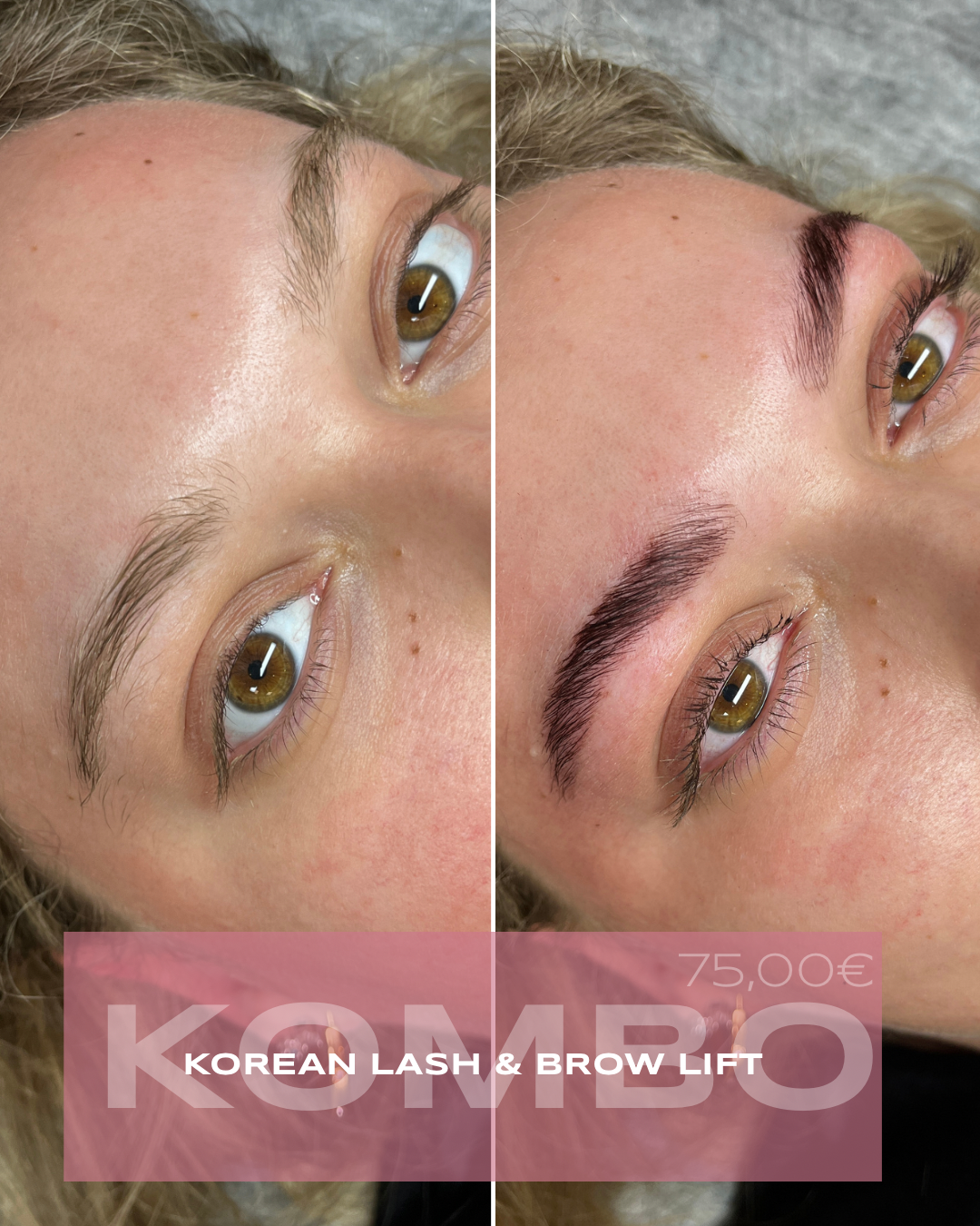 korean laninácia obočia v košiciach